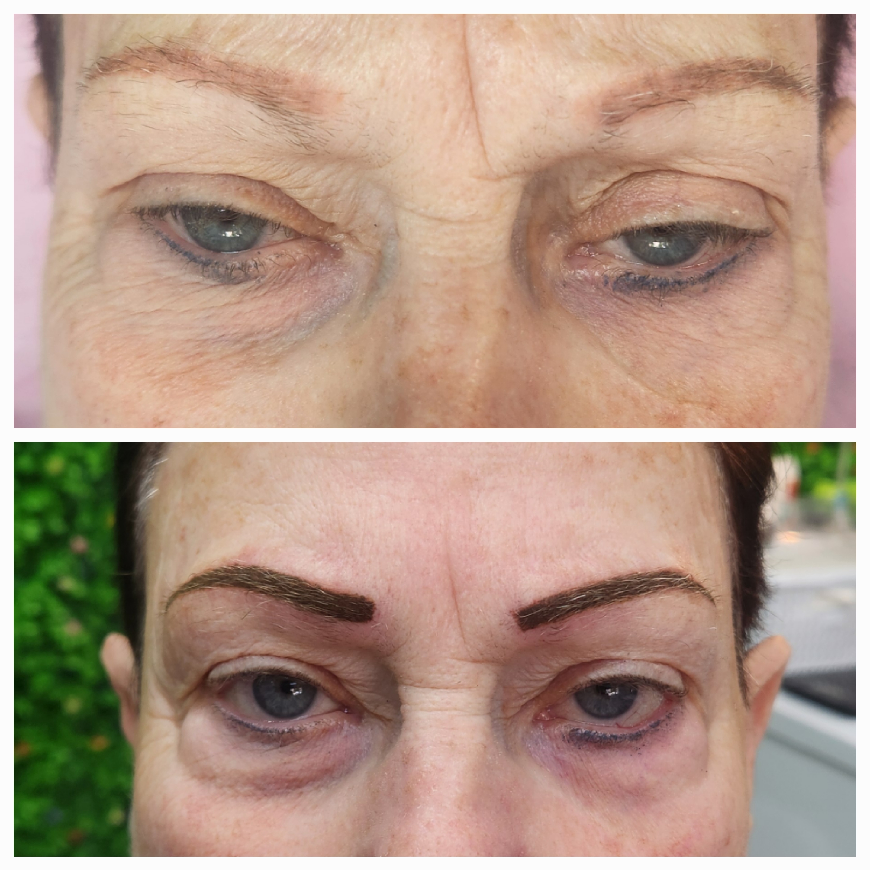 גבות לפני ואחרי